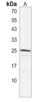 GSTA4 Rabbit Polyclonal Antibody