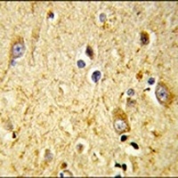 GSTA4 Rabbit Polyclonal Antibody
