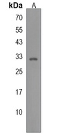C1QTNF6 Rabbit Polyclonal Antibody