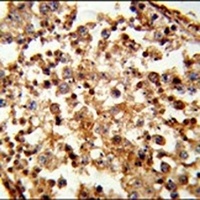 C1QTNF6 Rabbit Polyclonal Antibody