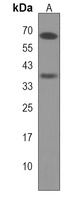ITGBL1 Rabbit Polyclonal Antibody
