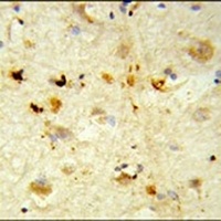 ITGBL1 Rabbit Polyclonal Antibody