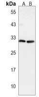 CTHRC1 Rabbit Polyclonal Antibody