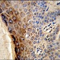 CTHRC1 Rabbit Polyclonal Antibody