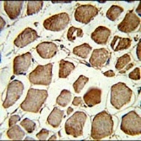 PLEKHO1 Rabbit Polyclonal Antibody