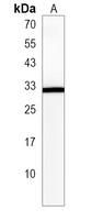 NME5 Rabbit Polyclonal Antibody