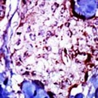 NME5 Rabbit Polyclonal Antibody