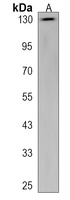 PKN2 Rabbit Polyclonal Antibody