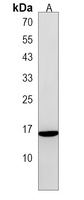 ALOX5AP Rabbit Polyclonal Antibody
