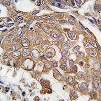 ALOX5AP Rabbit Polyclonal Antibody
