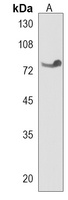 TNK1 Rabbit Polyclonal Antibody
