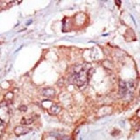 TNK1 Rabbit Polyclonal Antibody