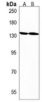 HIPK3 Rabbit Polyclonal Antibody