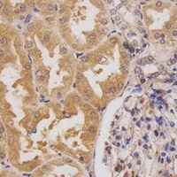 HIPK3 Rabbit Polyclonal Antibody