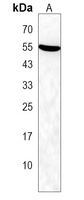 BTBD1 Rabbit Polyclonal Antibody