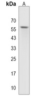 STK17A Rabbit Polyclonal Antibody