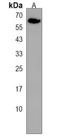 FPGS Rabbit Polyclonal Antibody