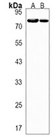 SRP72 Rabbit Polyclonal Antibody