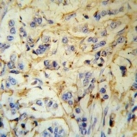 Fibrinogen alpha Rabbit Polyclonal Antibody