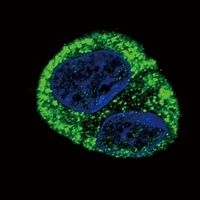Fibrinogen alpha Rabbit Polyclonal Antibody
