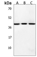 HSD17B7 Rabbit Polyclonal Antibody