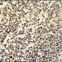 MAML3 Rabbit Polyclonal Antibody