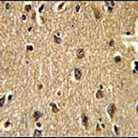 CLUAP1 Rabbit Polyclonal Antibody