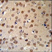 AMER1 Rabbit Polyclonal Antibody