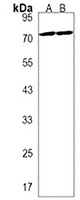 ZBTB7B Rabbit Polyclonal Antibody