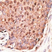 ZMIZ1 Rabbit Polyclonal Antibody