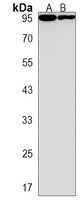 AFTPH Rabbit Polyclonal Antibody