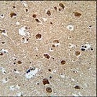 AFTPH Rabbit Polyclonal Antibody