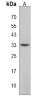 RSPO4 Rabbit Polyclonal Antibody