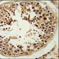 RSPO4 Rabbit Polyclonal Antibody