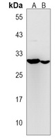 FGFBP3 Rabbit Polyclonal Antibody