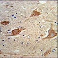FGFBP3 Rabbit Polyclonal Antibody