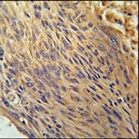 CPEB4 Rabbit Polyclonal Antibody