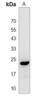 RBM24 Rabbit Polyclonal Antibody