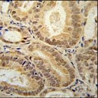 RBM24 Rabbit Polyclonal Antibody
