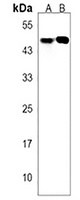 CD191 Rabbit Polyclonal Antibody