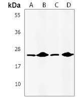 IL-24 Rabbit Polyclonal Antibody