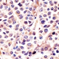 IL-24 Rabbit Polyclonal Antibody
