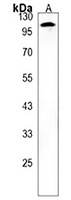 COG1 Rabbit Polyclonal Antibody