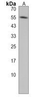RBCK1 Rabbit Polyclonal Antibody