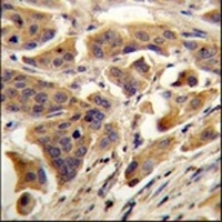 RBCK1 Rabbit Polyclonal Antibody