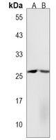 CXCL16 Rabbit Polyclonal Antibody