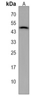 QTRT1 Rabbit Polyclonal Antibody