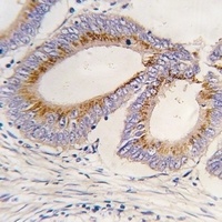 GDF11 Rabbit Polyclonal Antibody