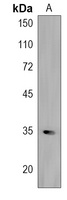 FBXL17 Rabbit Polyclonal Antibody