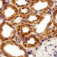 FBXL17 Rabbit Polyclonal Antibody